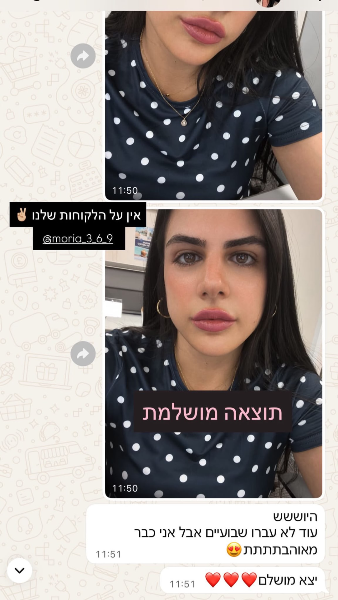 מטופלת מרוצה, כמה שבועות אחרי