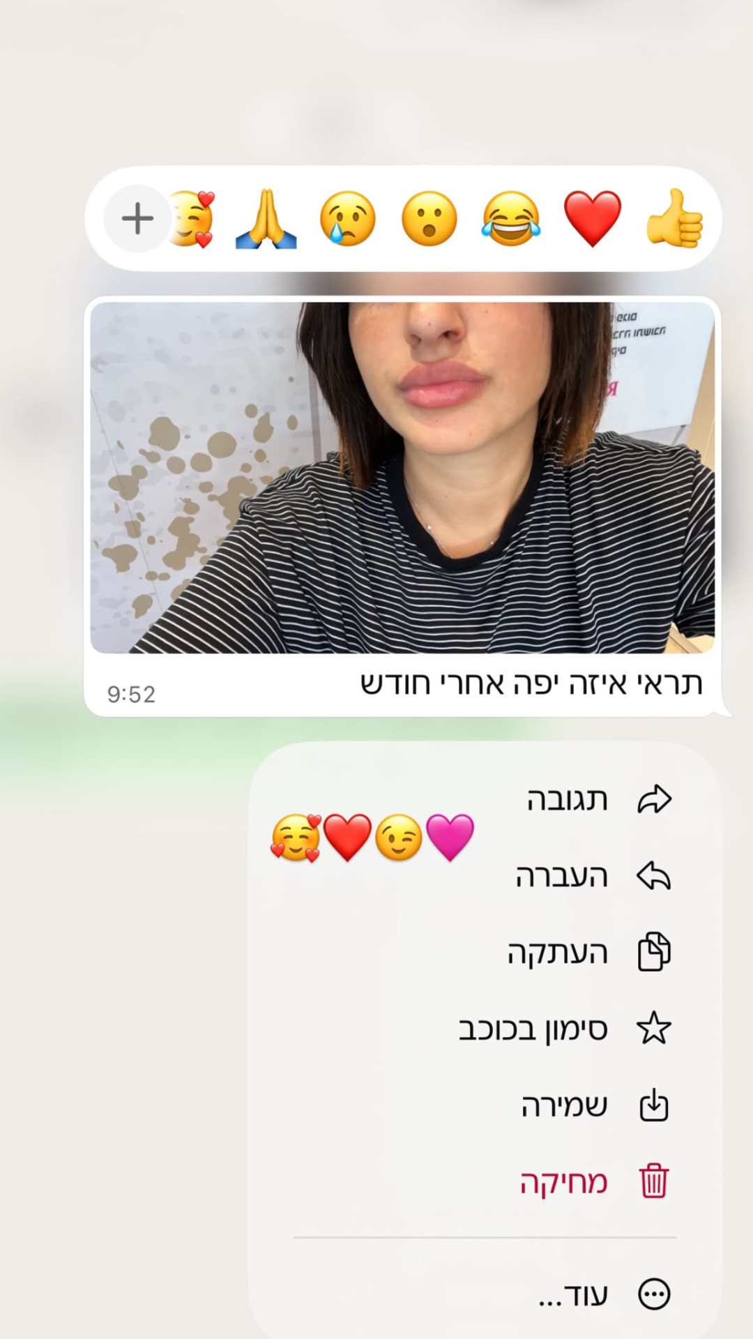 תודה אישית אחרי הטיפול